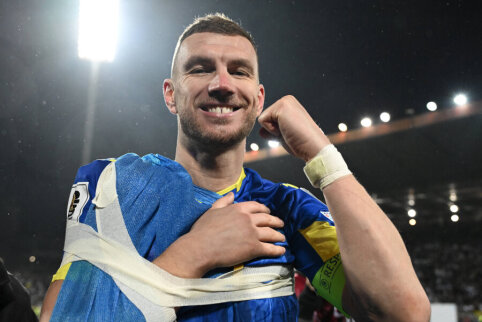 E. Džeko commented on his hand injury and the fate that occurred.