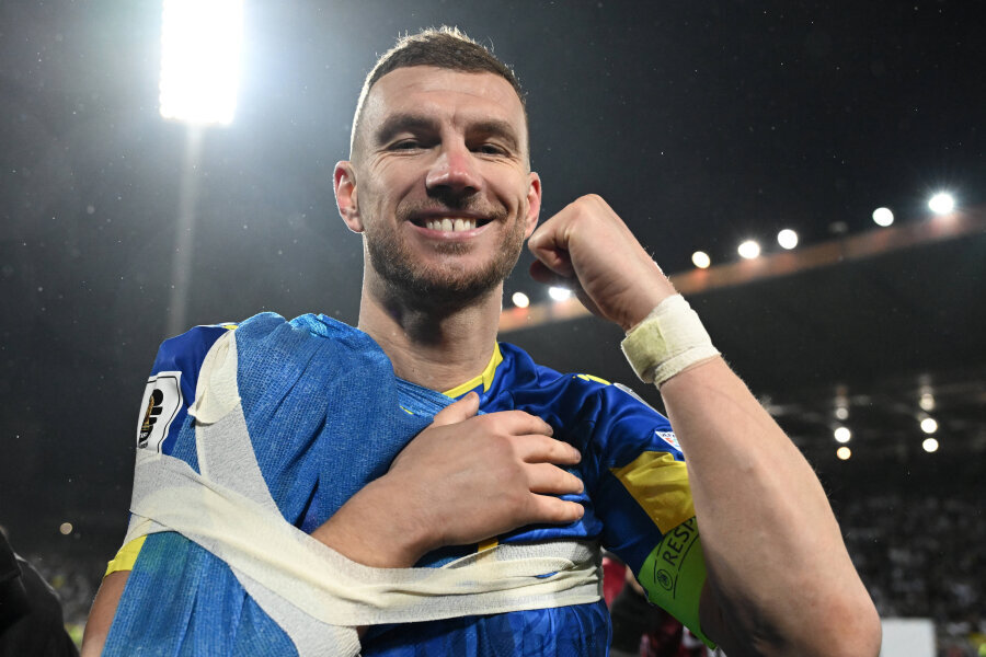 E. Džeko commented on his hand injury and the fate that occurred.